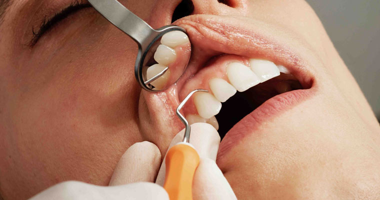 Cosmetic-Dentistry