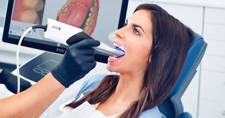 Digital-Intraoral-Scanning