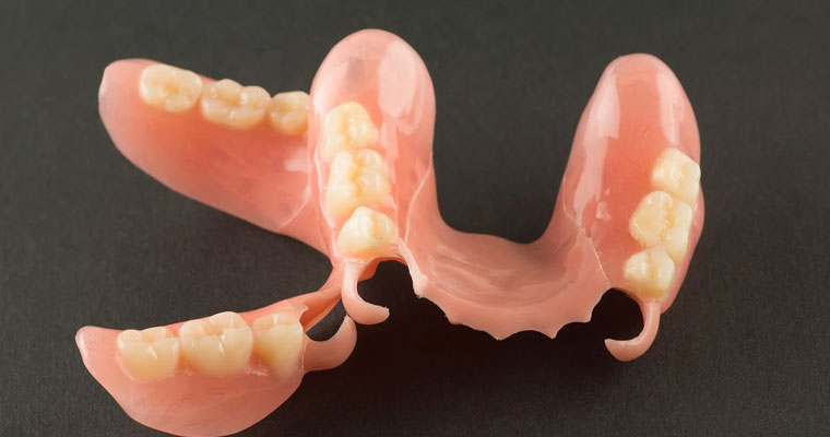 Flexi-Denture